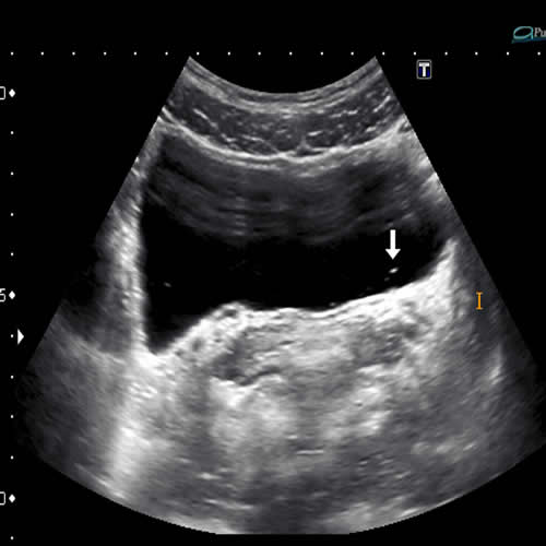 ilustracija snimke UZV abdomena