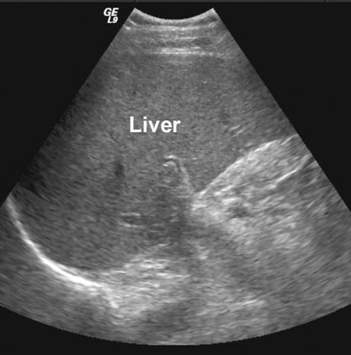 ilustracija snimke ultrazvuka abdomena
